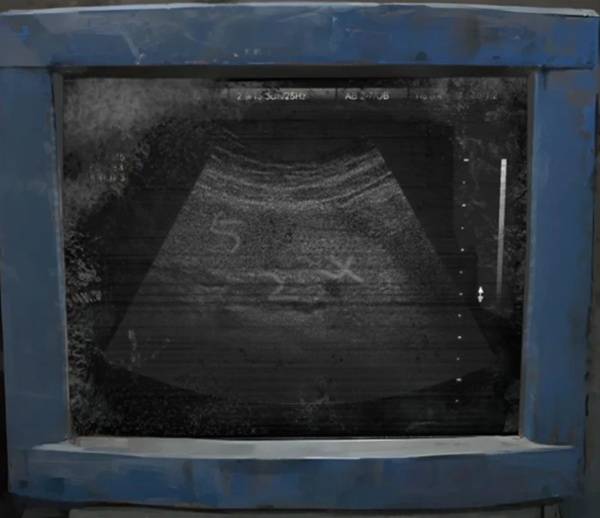 纸嫁衣8第一章攻略4