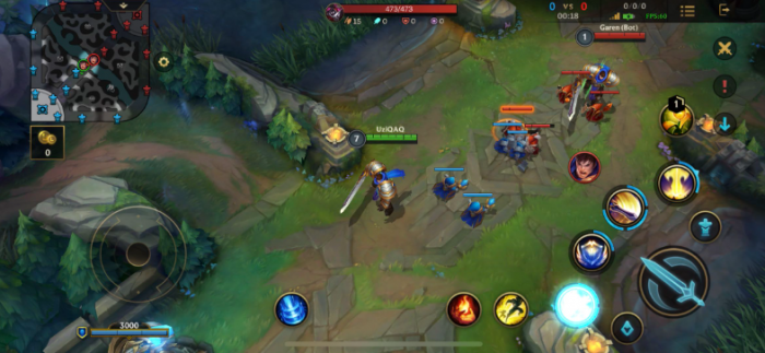 英雄联盟手游德玛如何出装1